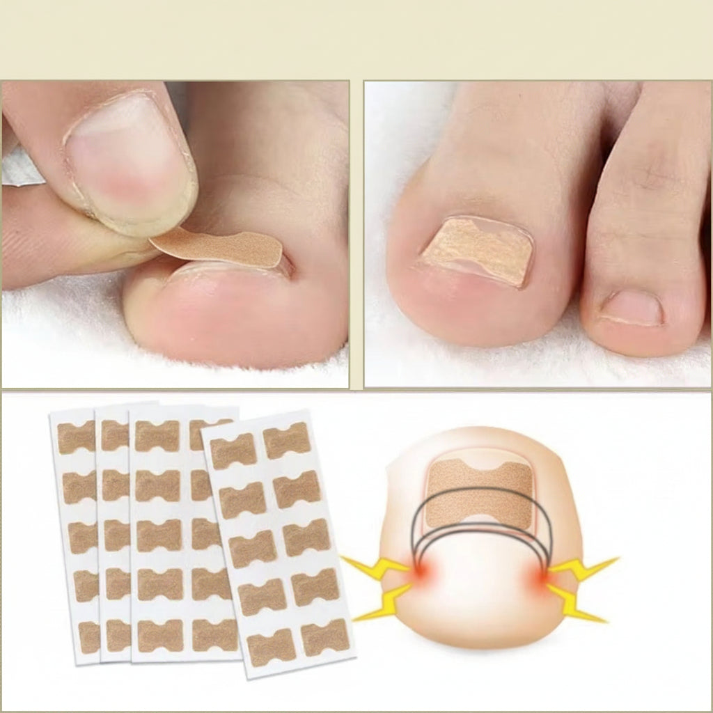 10+10 GRATIS | FixaNail - Sofortige Nagelreparatur - Image 3