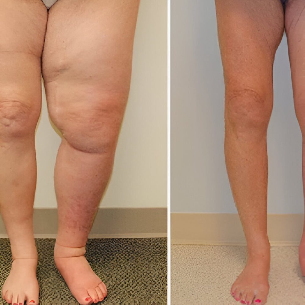 Magnetring Edelstahl Gesundheitstherapie Schmuck