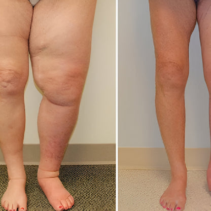 Magnetring Edelstahl Gesundheitstherapie Schmuck