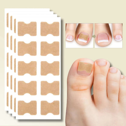 10+10 GRATIS | FixaNail - Sofortige Nagelreparatur