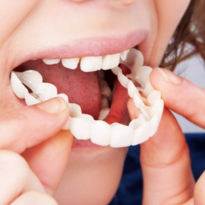 Zahnverblendung Ober Unterkiefer Veneers Set Zähne Weiß Lächeln